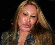 Jocelyn-Wildenstein-Cat-Woman-Plastic-Surgery-lip-injections-Before-and-After-Photos-Worst-Plast.jpg