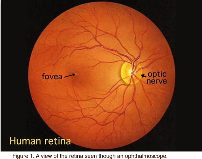 huretina.jpeg